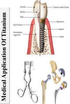 کاربرد تیتانیوم در صنعت پزشکی و دندانپزشکی